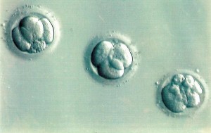 冷冻胚胎- 300×189